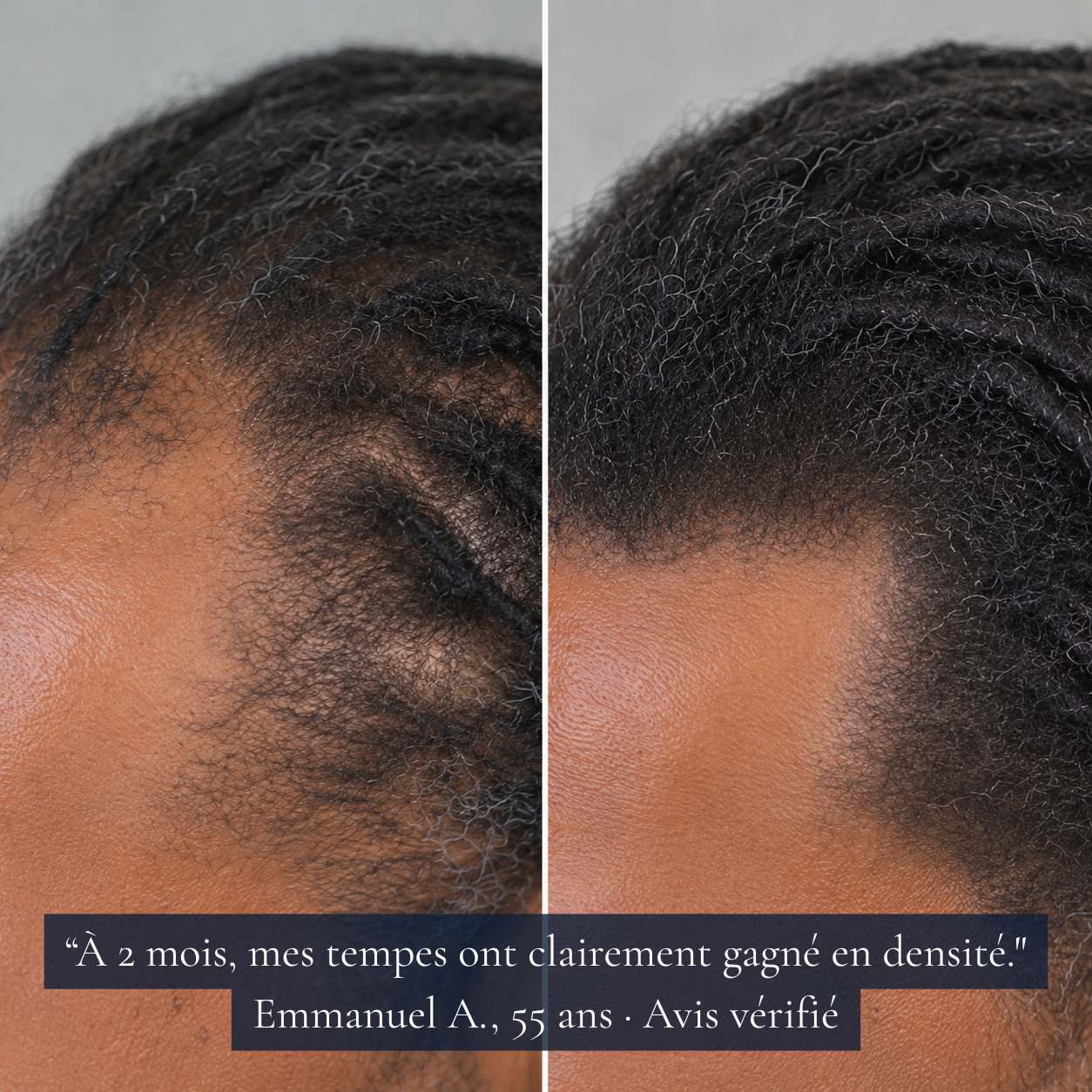 MAHÉ  Sérum Roll-On Densité & Repousse